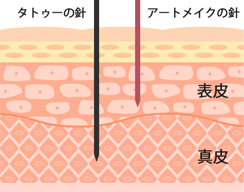 タトゥーの針　アートメイクの針